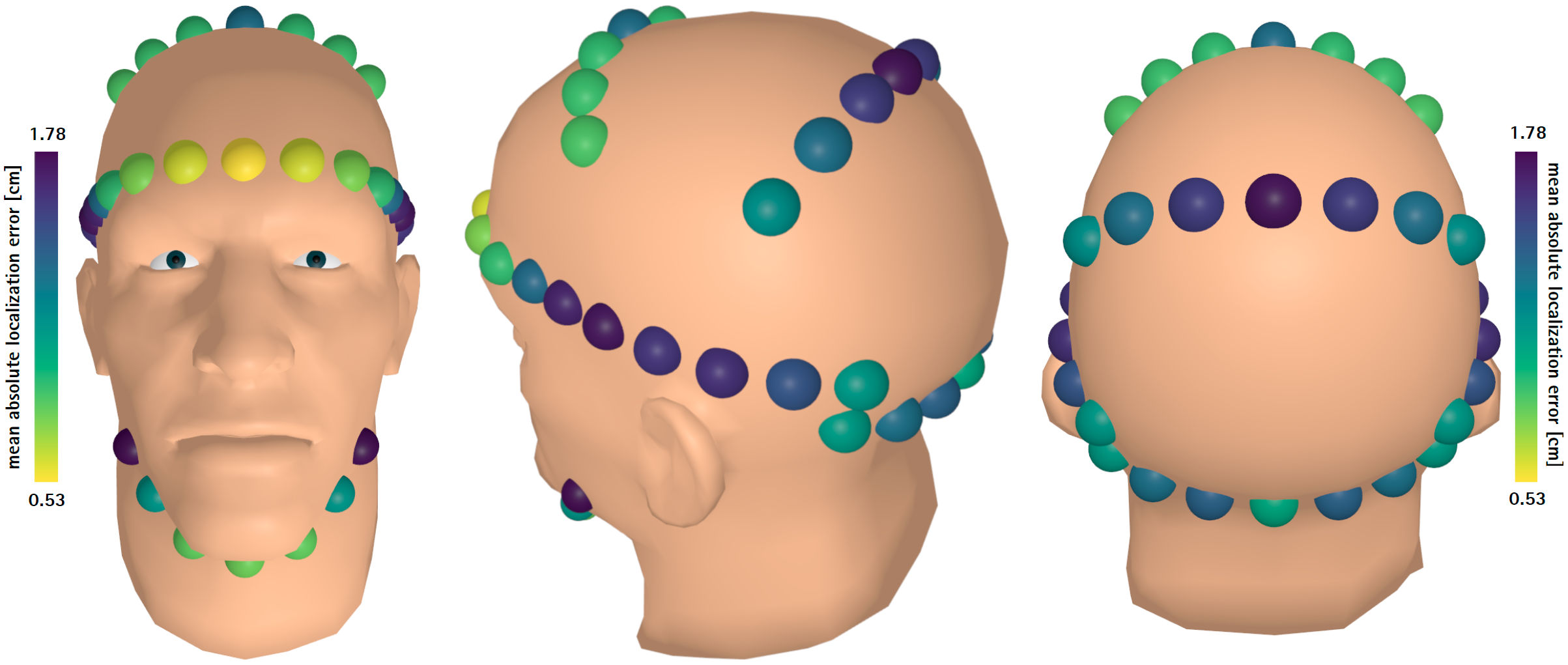 Around-the-Head Spatial Tactile System for Supporting Micro Navigation of Blind and Visually Impaired People